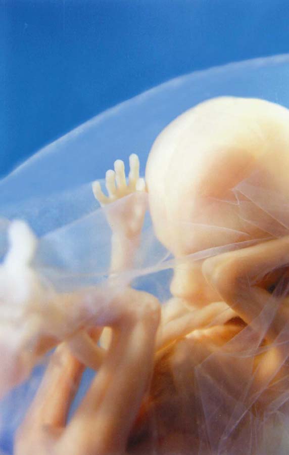 unborn baby at 3.5 months in womb